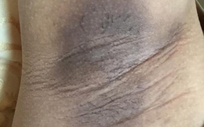怀孕腋窝变黑是男孩还是女孩(孕妇腋窝黑是生儿子吗)