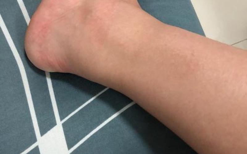 怀孕肿脚是怀男还是女(怀孕脚不肿)