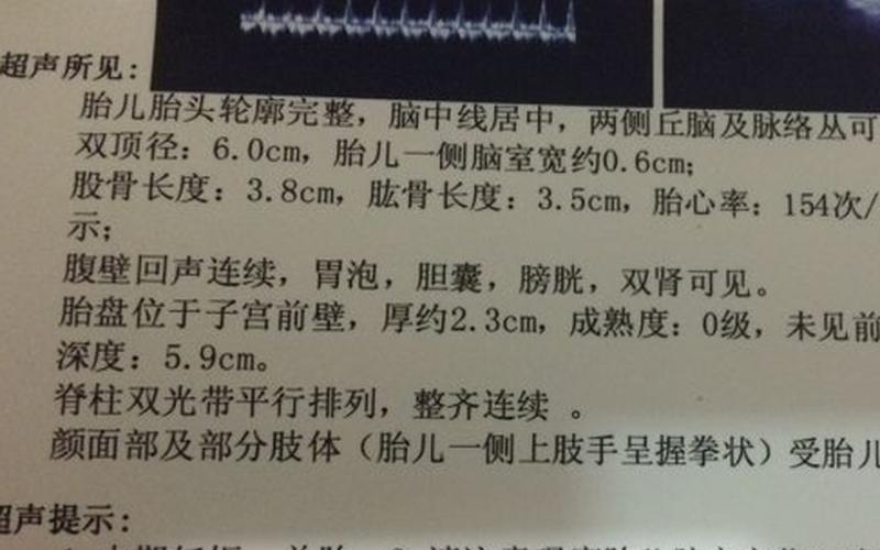 怀孕是做b超还是彩超(看肚子里的孩子b超还是彩超)