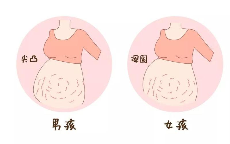 怀孕肚子是硬还是软(孕期肚子硬和软的区别)