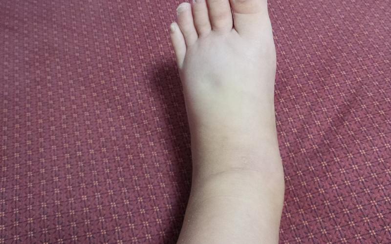 怀孕脚肿是男还是女(怀孕后期肿脚生男生女)