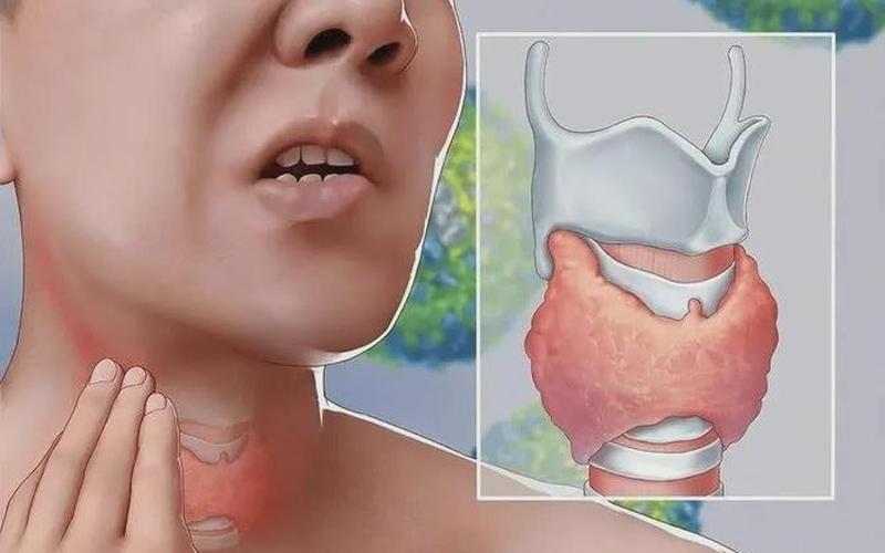 喉结位置是淋巴还是甲状腺(喉结两边是甲状腺吗)