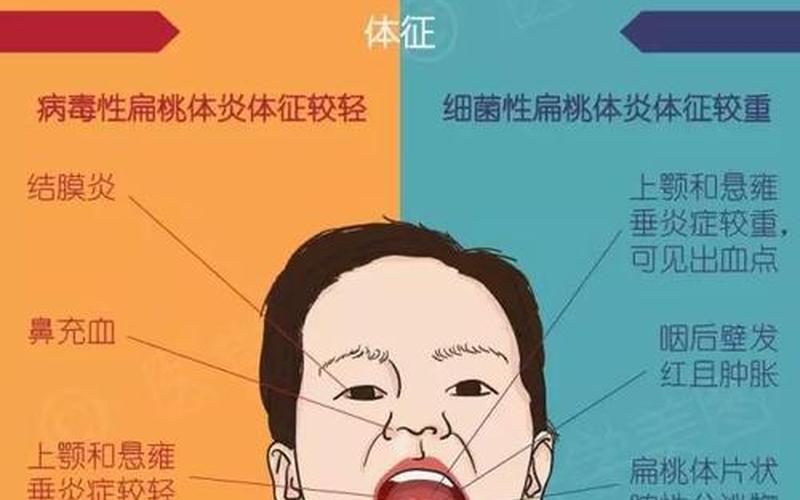 喉咙痛是细菌还是病毒(喉咙痛属于什么感染)