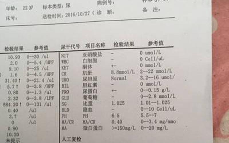 怀孕后尿液是酸性还是碱性(尿酸碱度7.0生男生女)