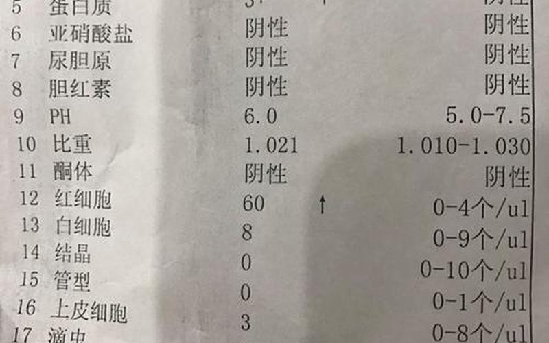 怀孕验尿是阳性还是阴性(尿常规阳性什么意思)